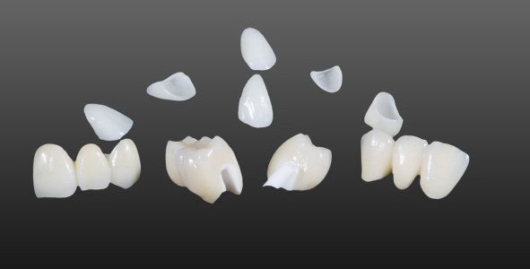 全瓷烤瓷牙價(jia) 格