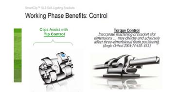 青少年牙齒矯正托槽