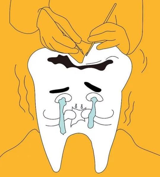 牙齒蛀牙