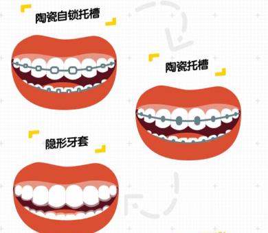 現在矯正牙齒多少錢