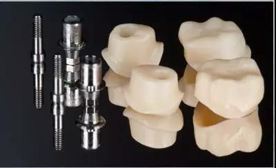 缺牙必須種牙嗎