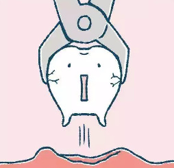 什麽(me) 時候拔牙比較好