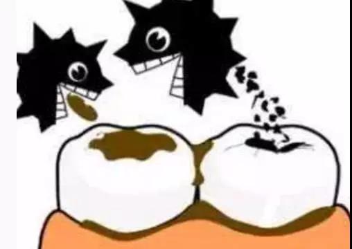 乳牙齲齒治療