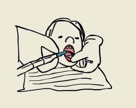 小孩牙齒矯正