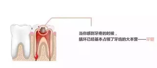 補牙需要時間