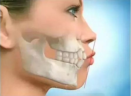 整牙等於(yu) 整容嗎？