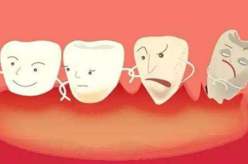 牙齦炎怎麽(me) 辦