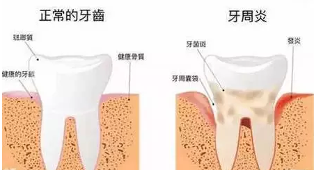 治療牙齦萎縮