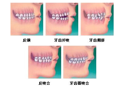 成人糾正牙齒疼嗎