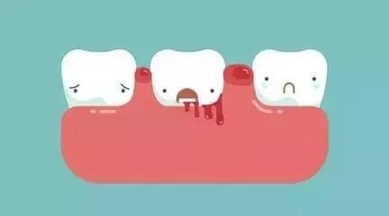牙齦出血圖片