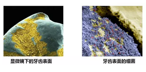 牙周炎檢查