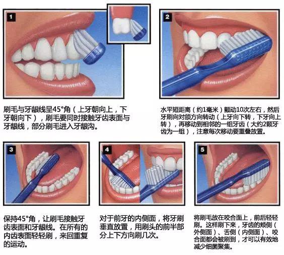 口腔檢查與(yu) 保健