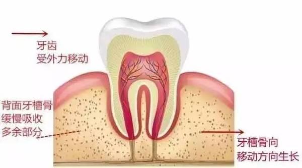 牙齒矯正後會(hui) 鬆動嗎