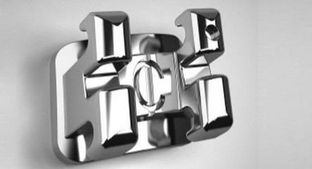 自鎖與(yu) 非自鎖金屬托槽