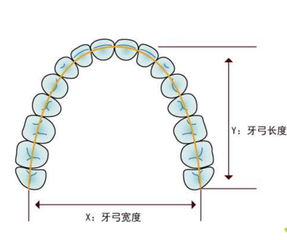 成年人牙齒擁擠擴弓還是拔牙矯正好？