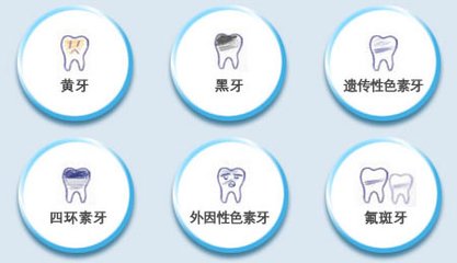 牙齒快速美白多少錢