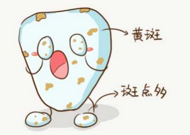 氟斑牙怎麽(me) 治療