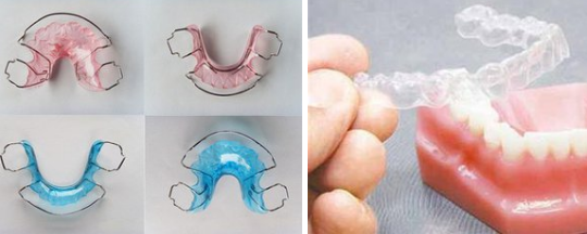 牙齒矯正保持器