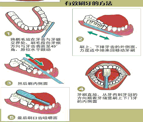 孕媽媽牙齒問題注意事項