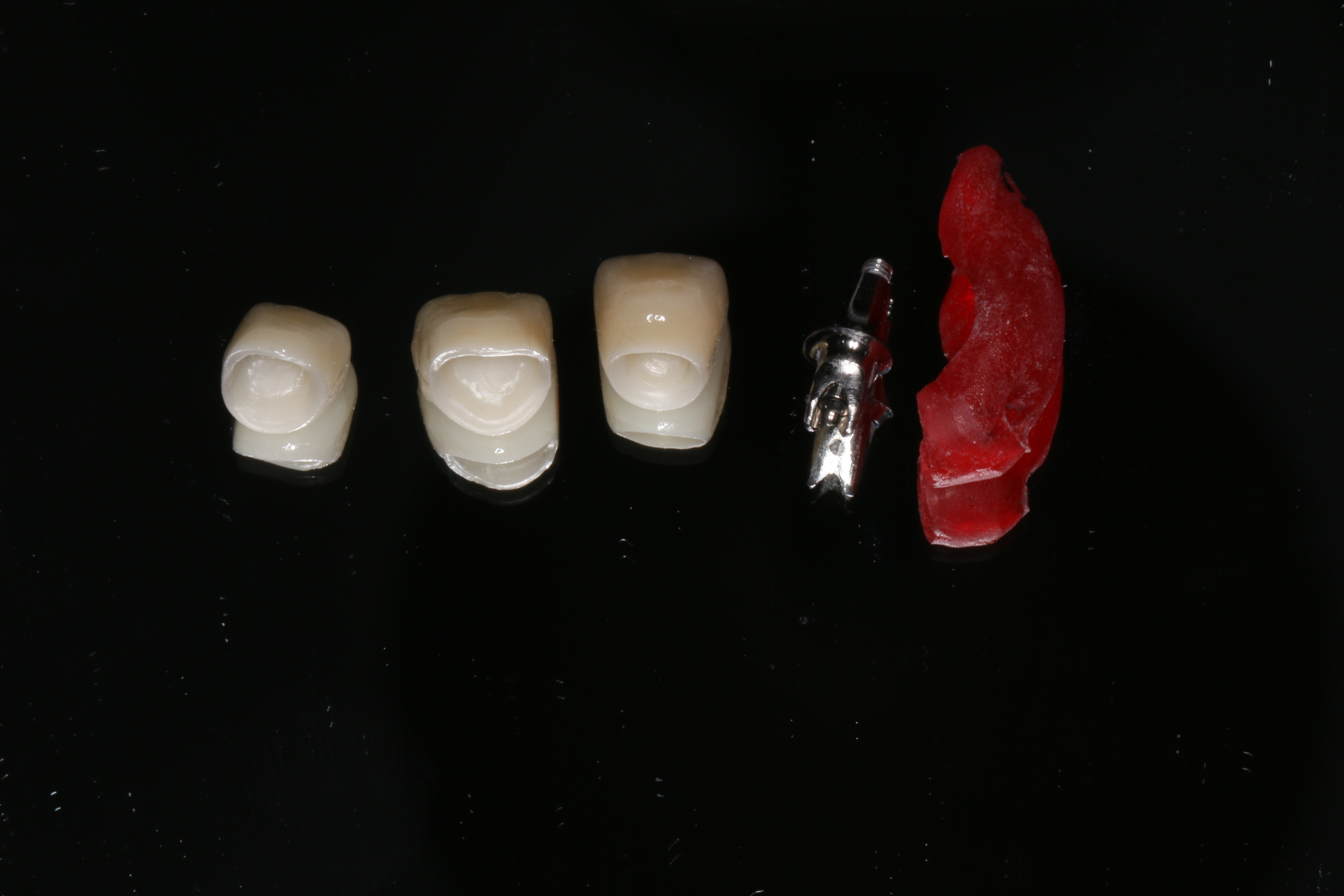 種植牙術後怎麽(me) 進行護理