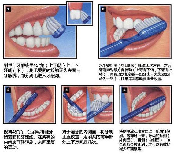 牙縫臭要怎麽(me) 辦