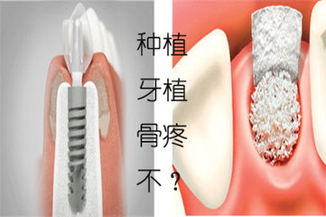 種植牙骨量不足怎麽(me) 辦