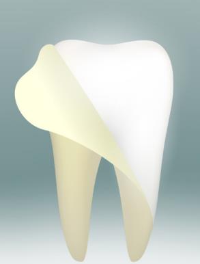 牙齒美白有什麽(me) 要求