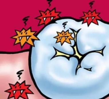 窩溝封閉後能管多久