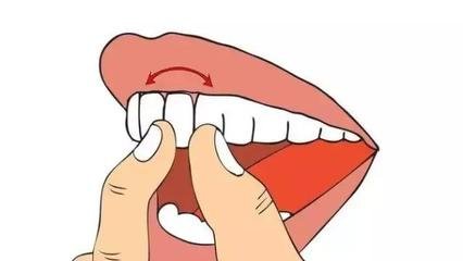 牙齒鬆動圖片