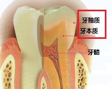 孩子牙黃有黑色斑點