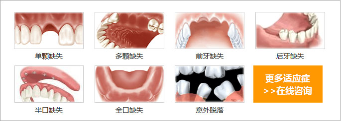 種植牙手術疼不疼