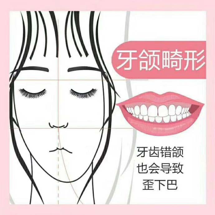 大學生矯正牙齒有沒有優(you) 惠