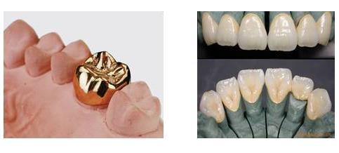 磨牙矯正牙齒好嗎