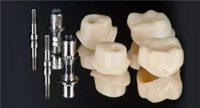 種牙齒價(jia) 格