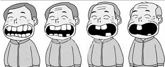 多顆種植牙怎麽(me) 計算費用