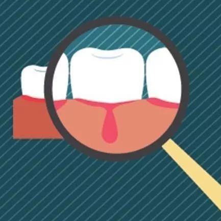 牙齦炎症狀圖片