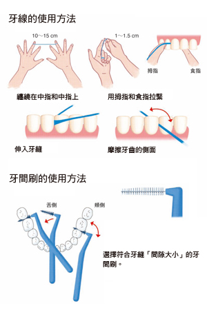 牙線和牙間刷的使用