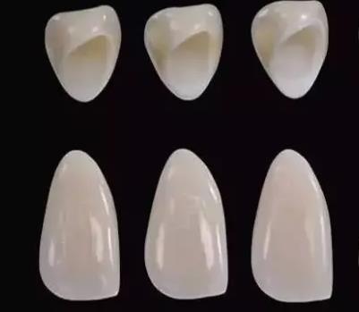 威蘭(lan) 德全瓷牙能不能做磁共振