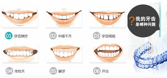 隱適美付費方式