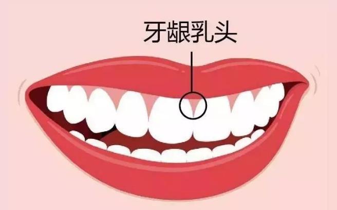 牙縫疙瘩怎麽(me) 回事