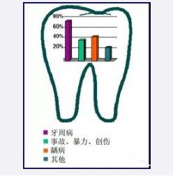 種植牙圖片