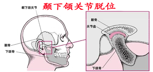 顳頜關(guan) 節不好