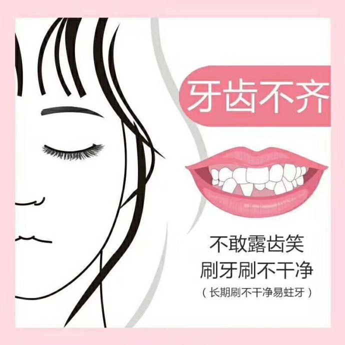 深圳青年牙齒正畸