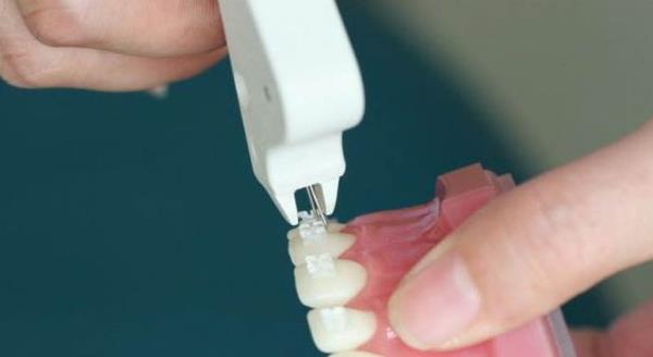 深圳牙齒矯正多少錢