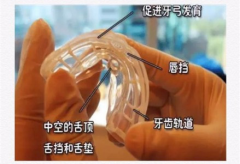 深圳小兒牙齒正畸方法
