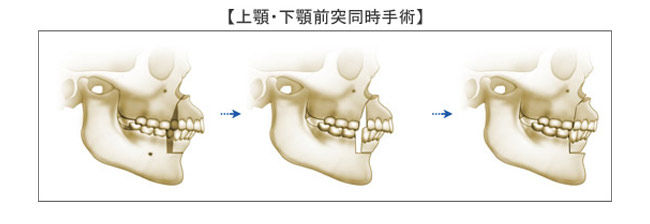 牙齒手術正畸