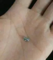 牙齒托槽掉了怎麽(me) 辦