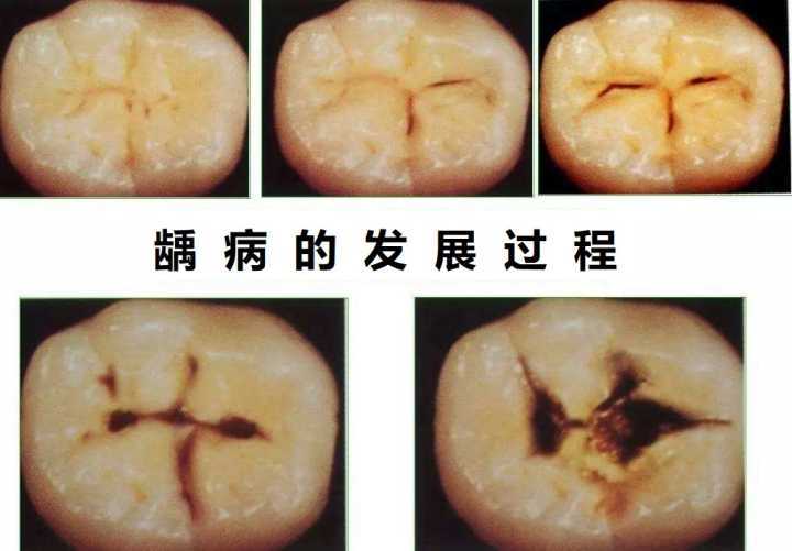 綜合醫院口腔科可以補牙嗎