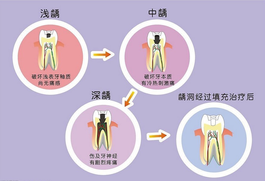 醫院補牙可以用醫保嗎