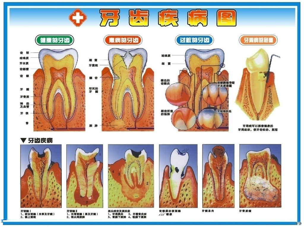牙病十大罪狀